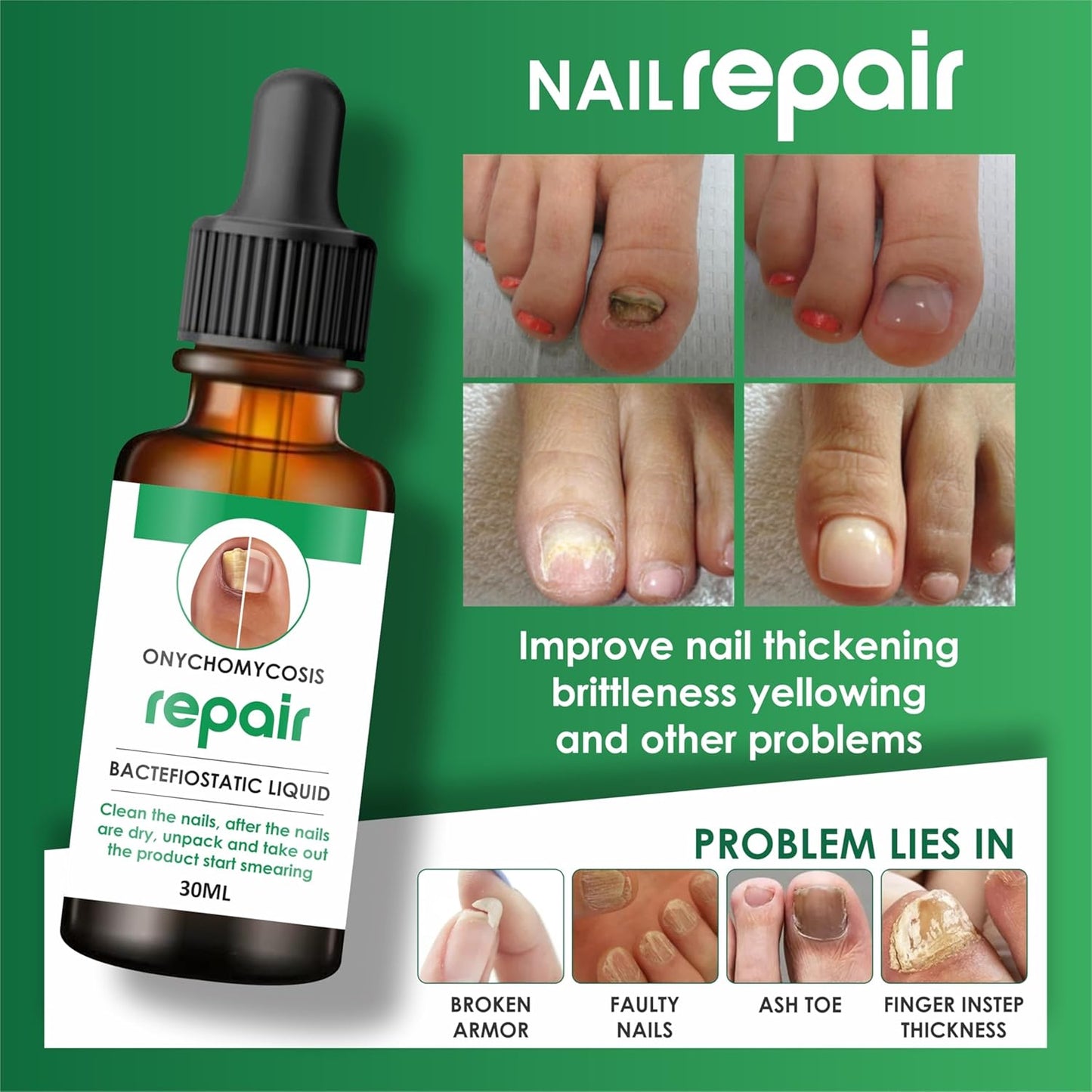 NailShield™ Nail Care Serum