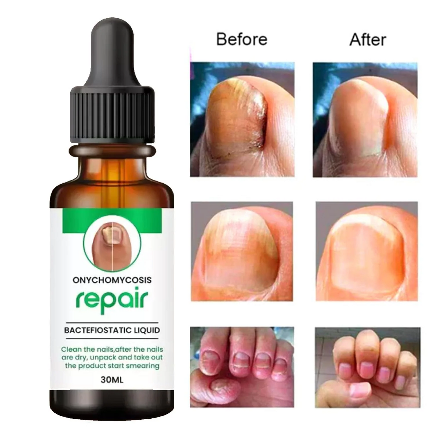 NailShield™ Nail Care Serum (Pack Of 2)