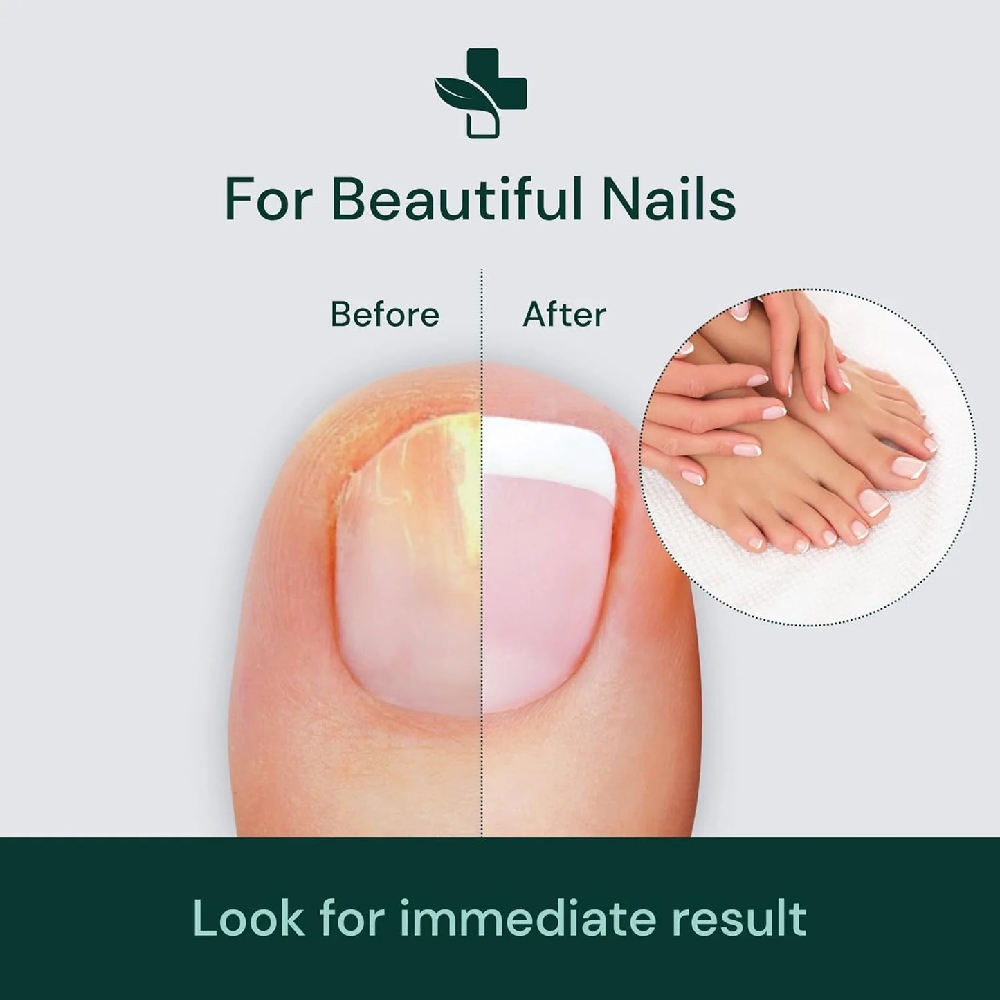 NailShield™ Nail Care Serum