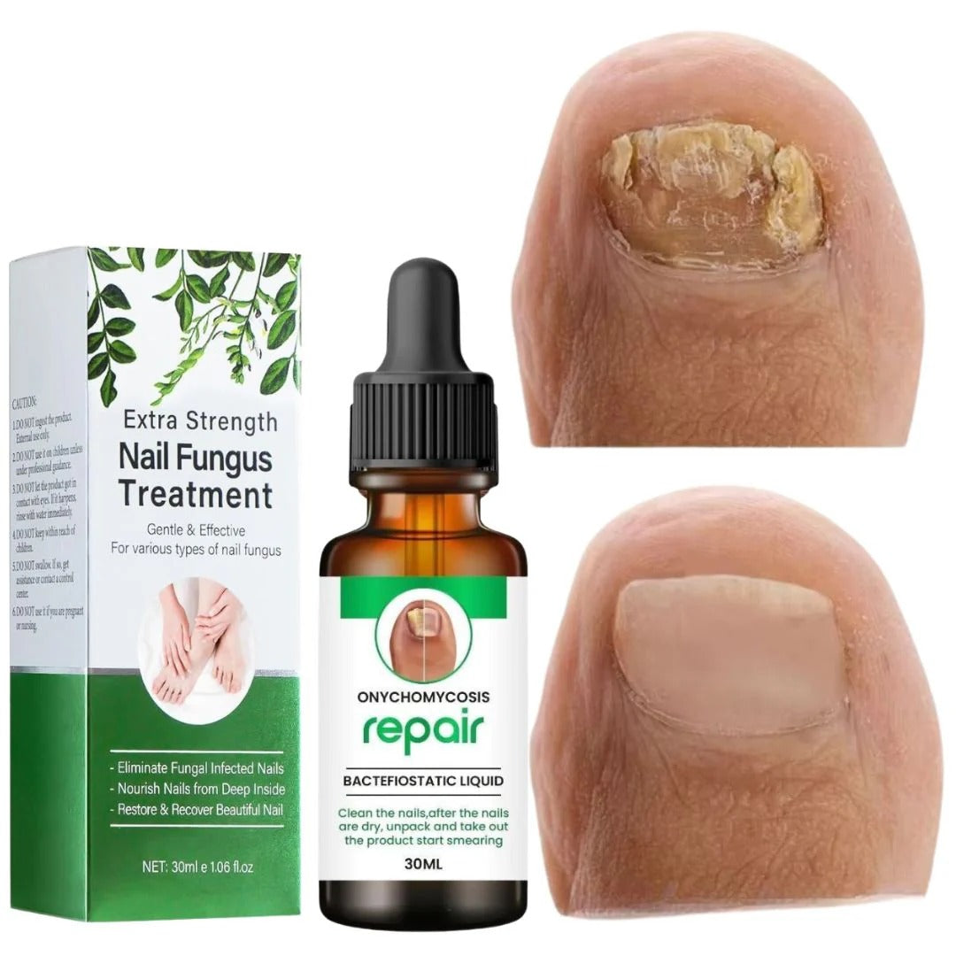 NailShield™ Nail Care Serum